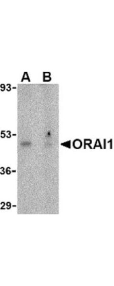 Anti-ORAI1 Antibody - Western Blot