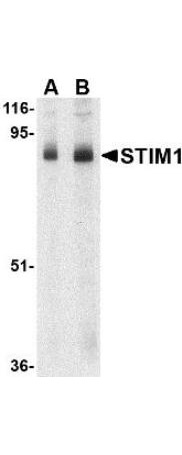 Anti-STIM1 Antibody - Western Blot