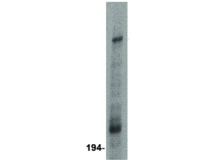 Western Blot of ARF-BP1 Antibody
