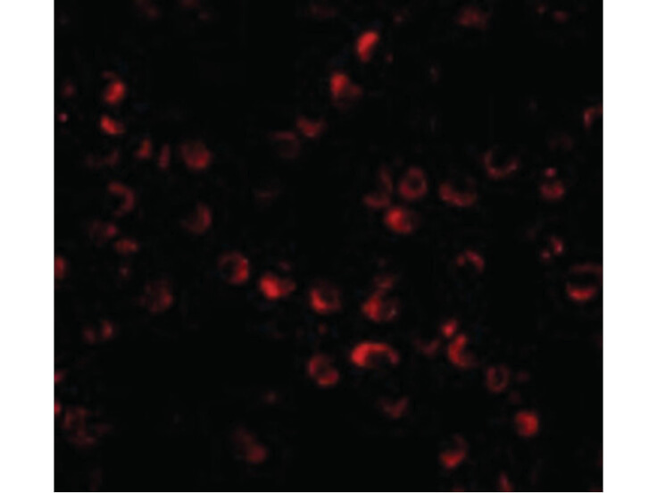 Immunofluorescence of ARF-BP1 Antibody