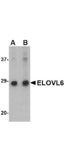 Anti-ELOVL6 Antibody - Western Blot