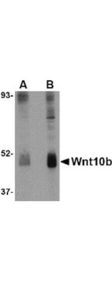 Anti-Wnt10b Antibody - Western Blot