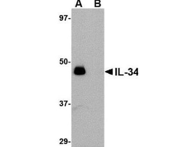 Anti-IL-34 Antibody - Western Blot