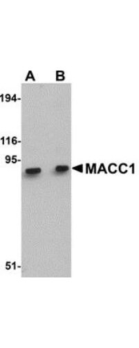Anti-MACC1 Antibody - Western Blot