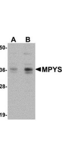 Anti-MPYS Antibody - Western Blot