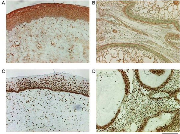 Immunohistochemistry using SMAD pT179