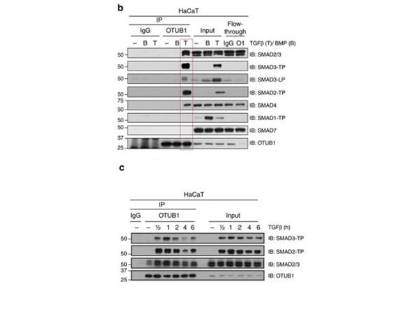 Western Blot using SMAD3 pT179