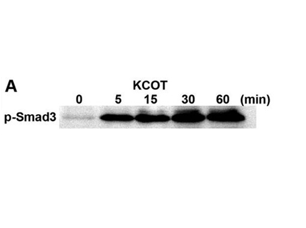 Western Blot using SMAD3 pT179