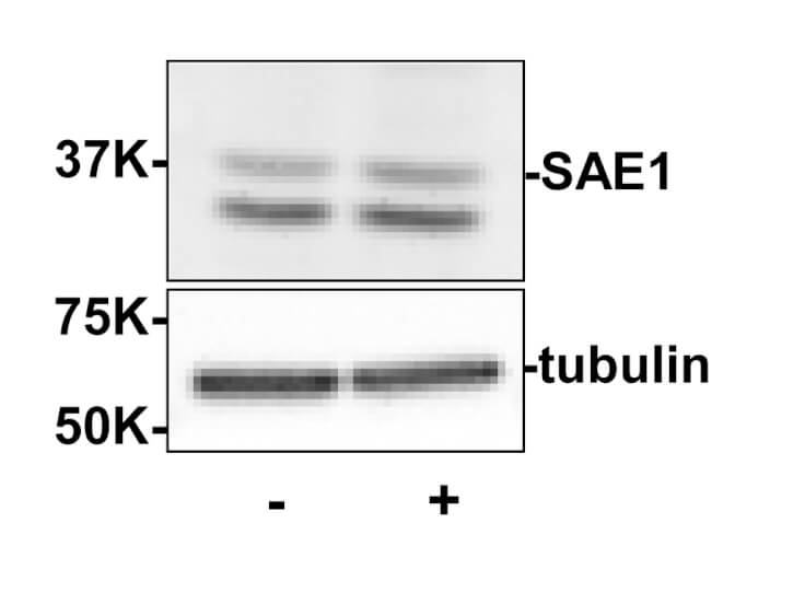 Western Blot - SAE1 Antibody