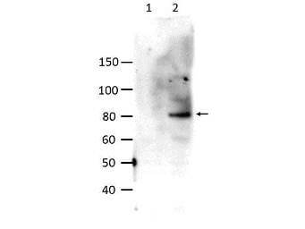 Anti-STAT6 pY641 Antibody - Western Blot