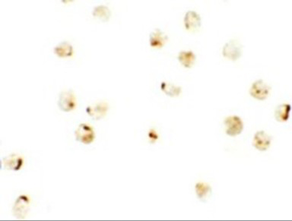 Immunocytochemistry of IRF2BP2