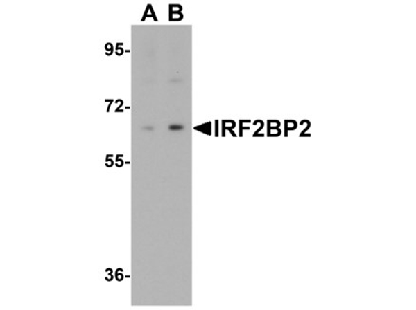 Western blot analysis of IRF2BP2