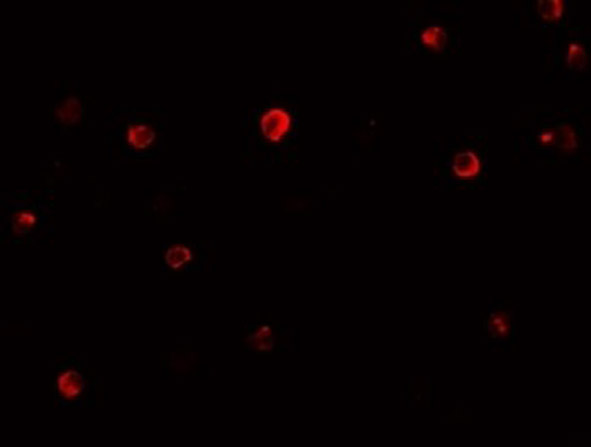 Immunofluorescence of IRF4.