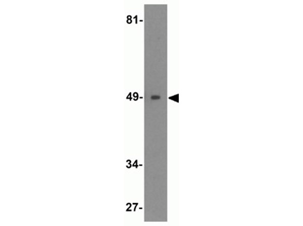 Western blot analysis of IRF4