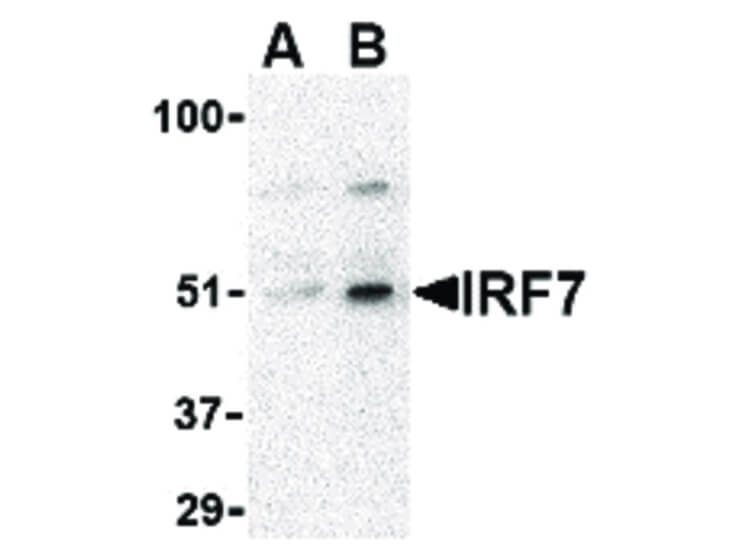 Western Blot of IRF7 Antibody