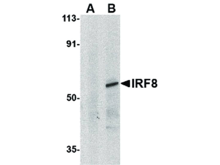 Western Blot of IRF8 Antibody