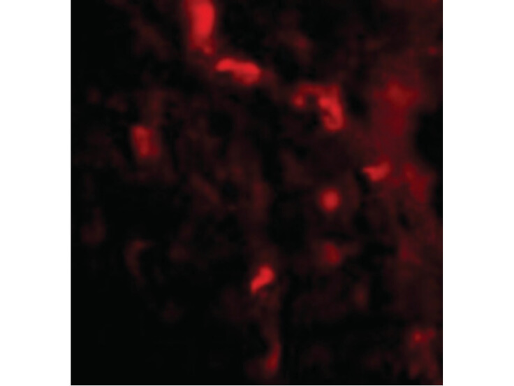 Immunofluorescence of IRGM Antibody