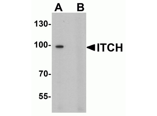 Western blot analysis of ITCH