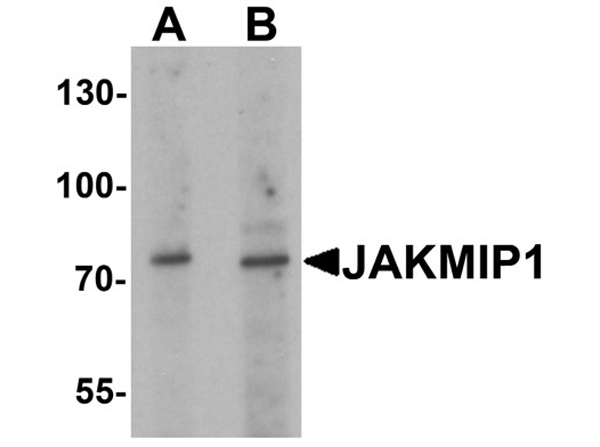 Western blot analysis of JAKMIP1