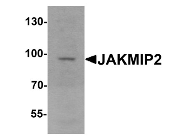 Western blot analysis of JAKMIP2