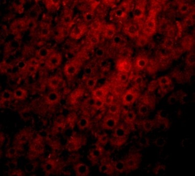 Immunofluorescence of JMJD1C