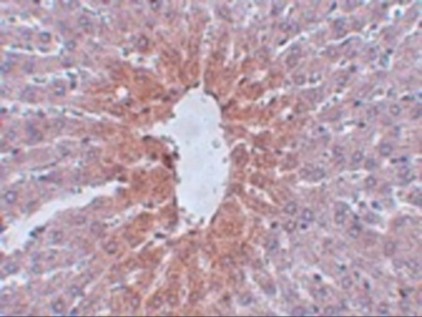 Immunohistochemistry of JMJD1C