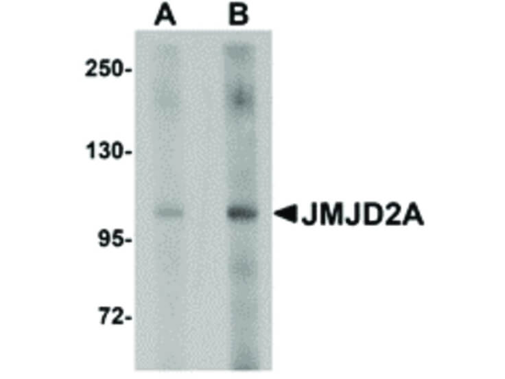 Western Blot of JMJD2A Antibody