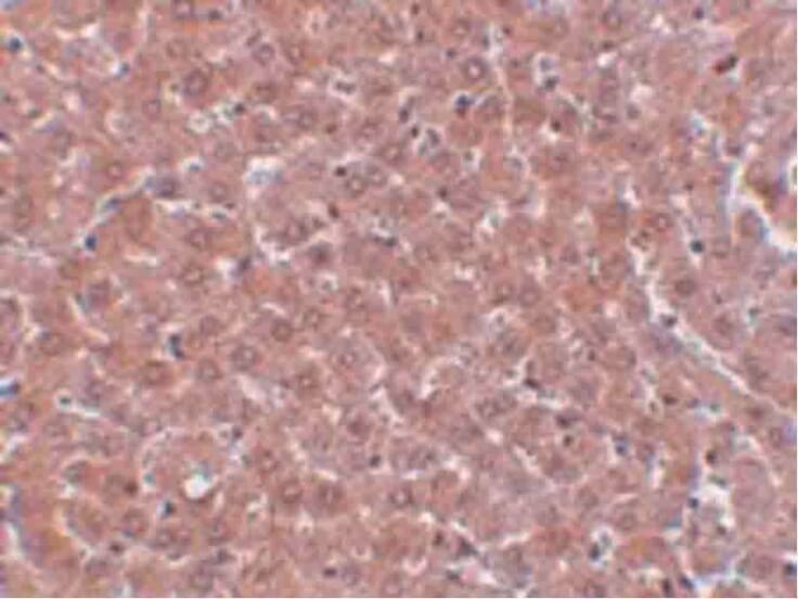 Immunohistochemistry of JMJD2A Antibody