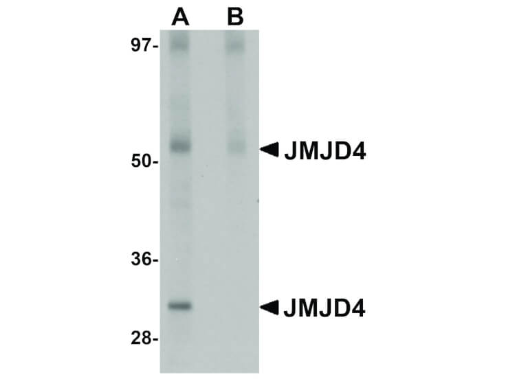 Western Blot of JMJD4 Antibody