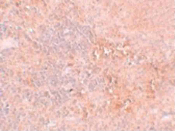 Immunohistochemistry of JMJD4 Antibody