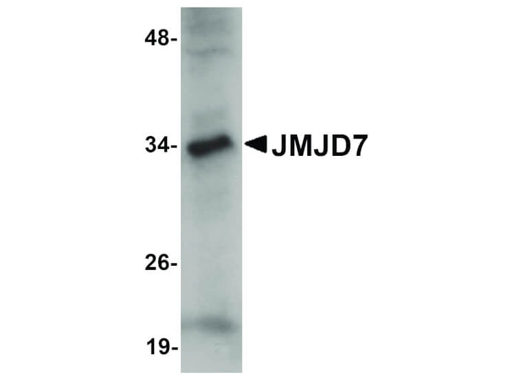 Western Blot of JMJD7 Antibody