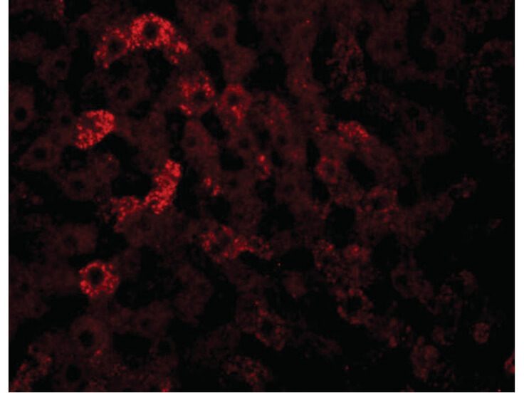 Immunofluorescence of JMJD7 Antibody