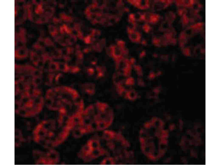 Immunofluorescence of JMJD8 Antibody