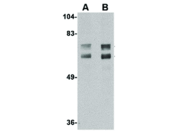 Western Blot of JPH2 Antibody