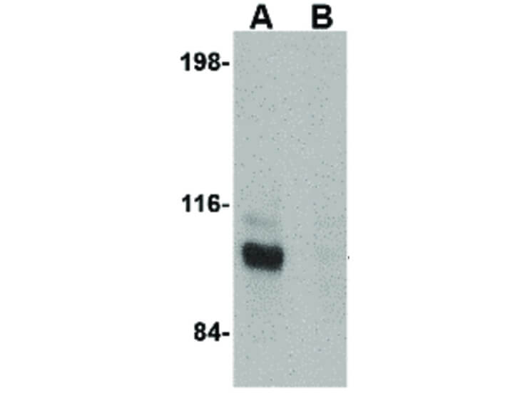 Western Blot of JPH3 Antibody