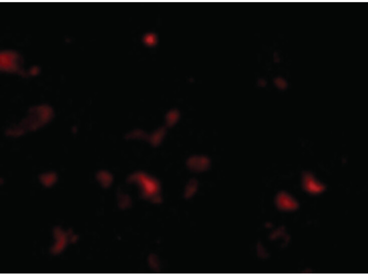 Immunofluorescence of JPH3 Antibody