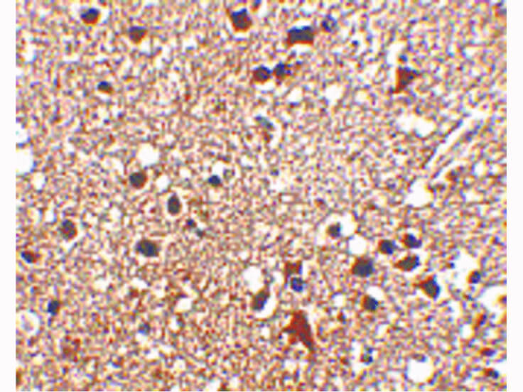 Immunohistochemistry of JPH3 Antibody