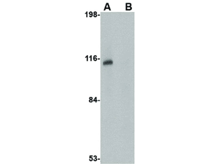 Western Blot of JPH3 Antibody