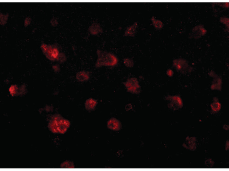Immunofluorescence of JPH3 Antibody