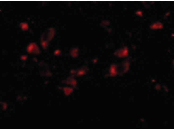 Immunofluorescence of JPH4 Antibody