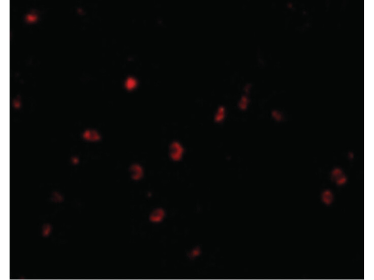 Immunofluorescence of KAI1 Antibody
