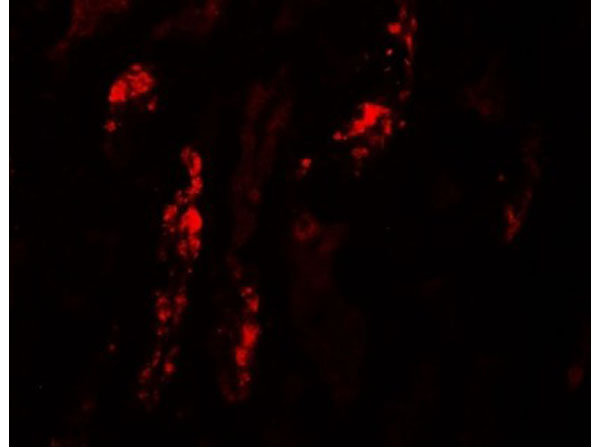 Immunofluorescence of KANK1