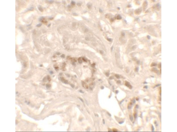 Immunohistochemistry of KANK1