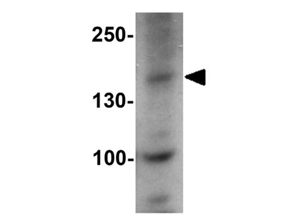 Western blot of KANK1