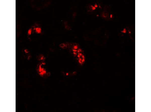 Immunofluorescence of KANK2