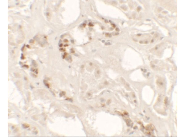 Immunohistochemistry of KANK2
