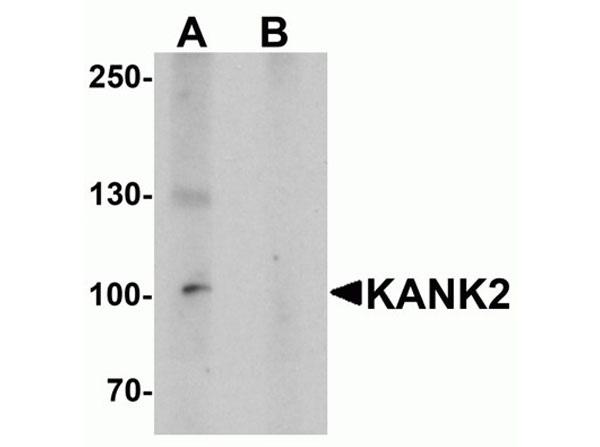 Western blot of KANK2