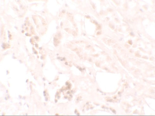 Immunohistochemistry of KANK3