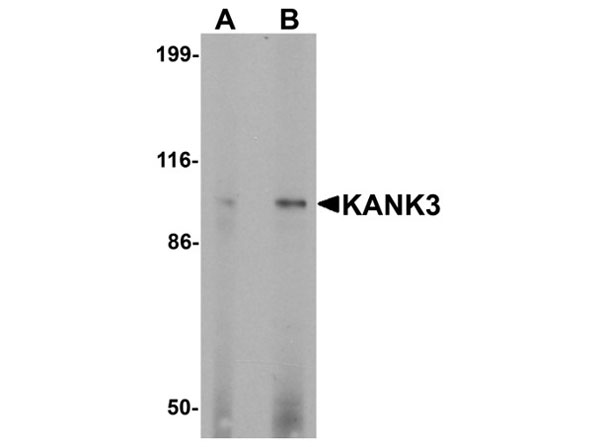 Western blot of KANK3