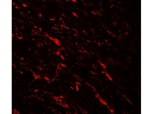 Immunofluorescence of KAT5